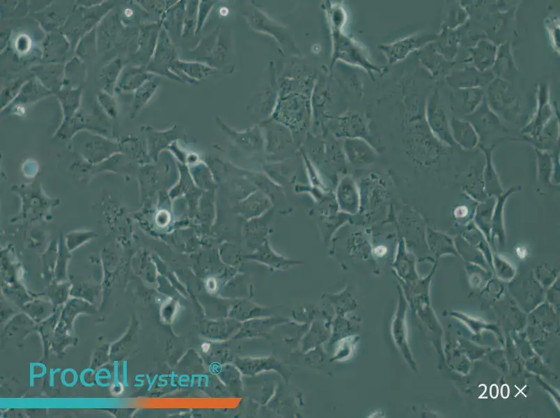 SK-OV-3 Cell Complete Medium - small - 5