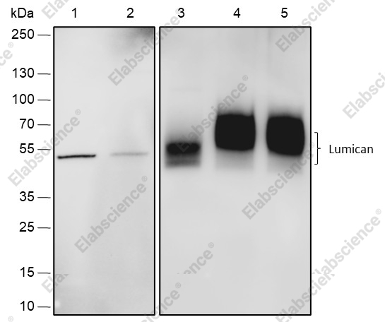 Recombinant Lumican Monoclonal Antibody - 1