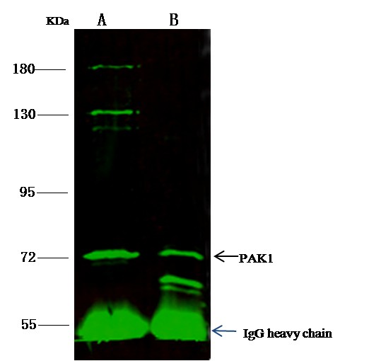 PAK1 Antibody Polyclonal Antibody - small - 2