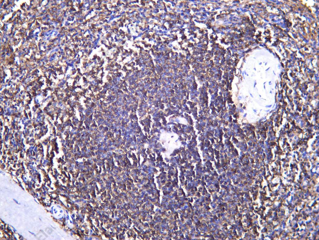 Recombinant CD32 Monoclonal Antibody - 1