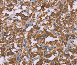 Cyclophilin F Polyclonal Antibody - 2