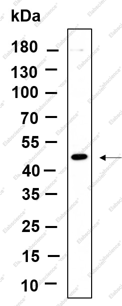 Recombinant DPS1 Monoclonal Antibody - 1