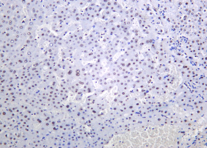 Recombinant Nucleophosmin Monoclonal Antibody - small - 2