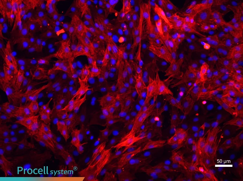 Rat Aortic Smooth Muscle Cells - 1