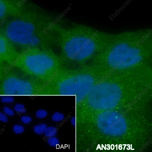Recombinant Thrombomodulin Monoclonal Antibody - 3