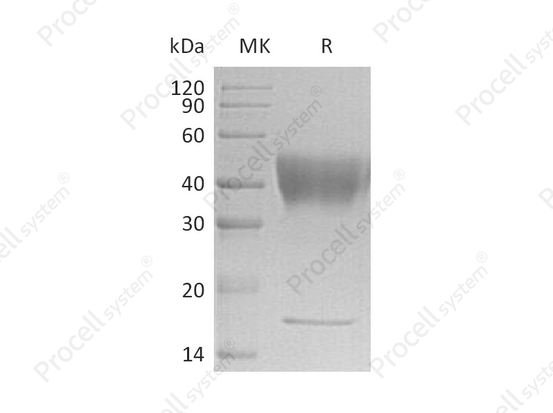 IFNGR1/CD119, Human, Recombinant