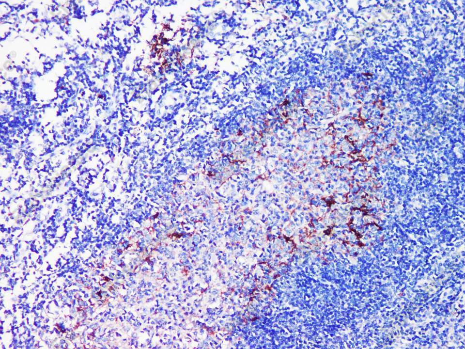 IDO1 Polyclonal Antibody - 2
