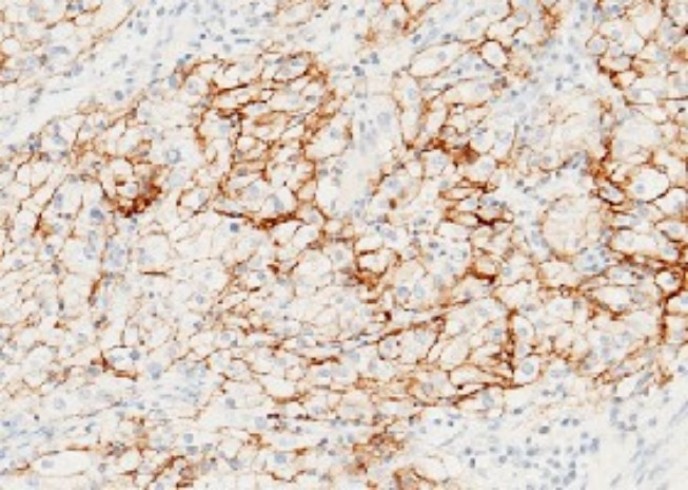 Recombinant Carbonic Anhydrase IX/CA9 Monoclonal Antibody - small - 4