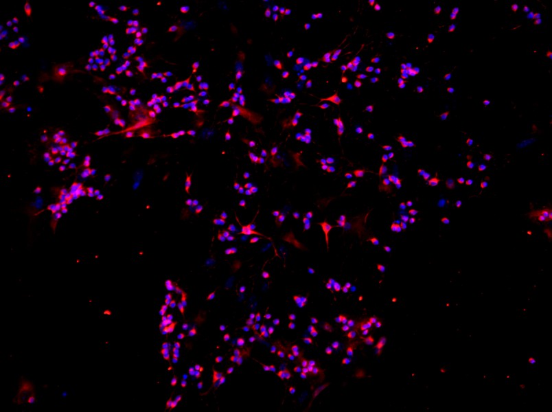 Mouse Retinal Ganglion Cell Complete Medium - 3
