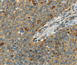 AIF1 Polyclonal Antibody - 3