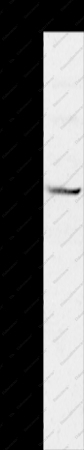 MVK Polyclonal Antibody - 1