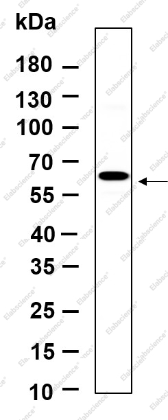 Recombinant Phospho-p70 S6 kinase β (Ser371) Monoclonal Antibody - 1