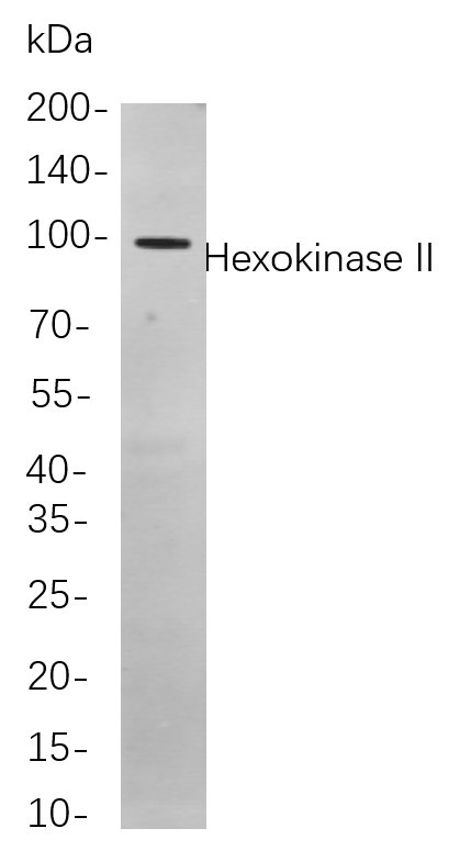 Recombinant Hexokinase II Monoclonal Antibody-searchlist-1