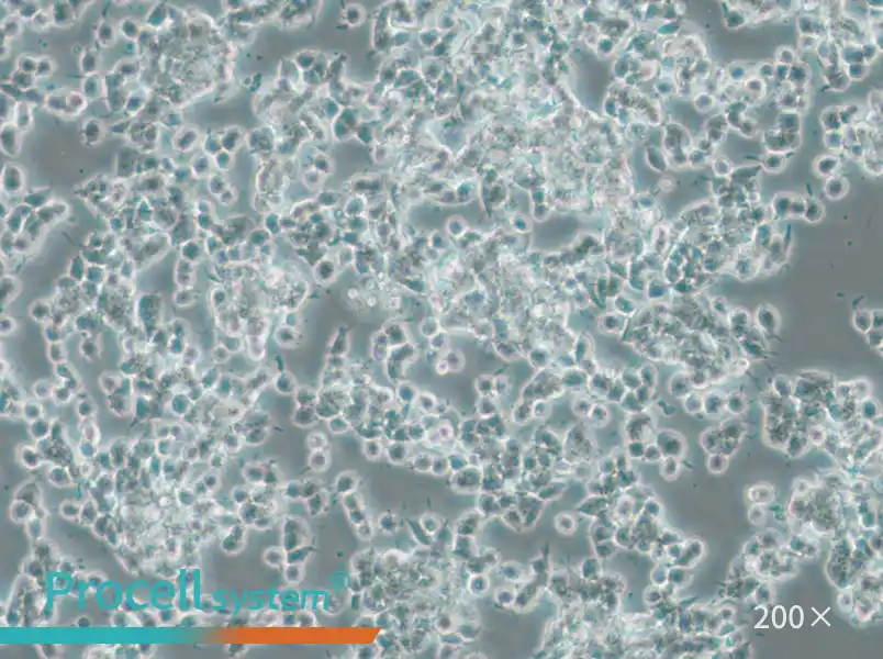 SK-NEP-1 Cell Complete Medium - 6