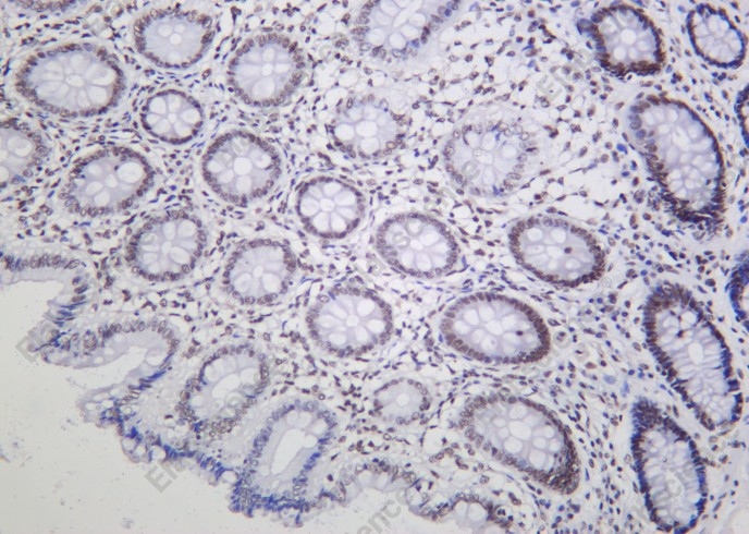 Recombinant SMC3 Monoclonal Antibody - 2