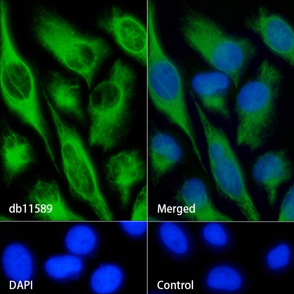 Recombinant Vimentin/VIM Monoclonal Antibody - small - 5
