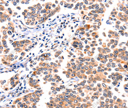 GNRHR Polyclonal Antibody - 2