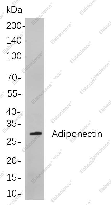 Recombinant Adiponectin Monoclonal Antibody - 1