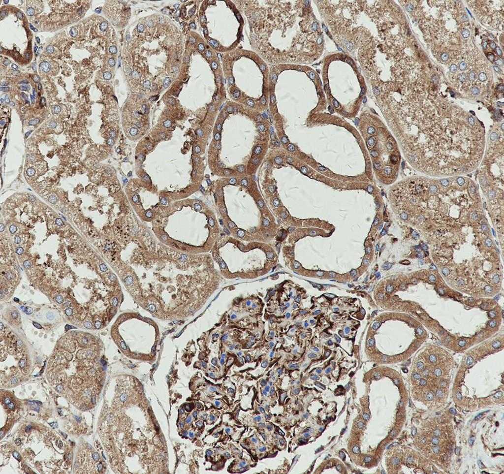 Recombinant NAP1L1 Monoclonal Antibody - 3