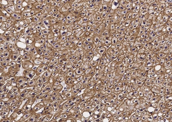 Recombinant ASGR2/ASGPR2 Monoclonal Antibody - small - 4