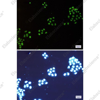 Recombinant NAT10 Monoclonal Antibody - 2