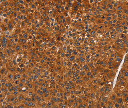 CDK19 Polyclonal Antibody - 2
