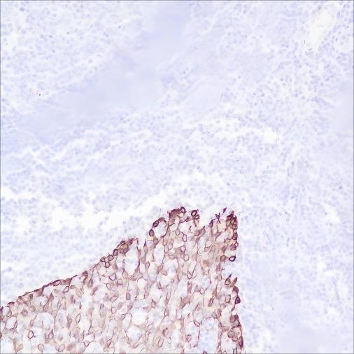 Recombinant Keratin 16 Monoclonal Antibody - 3