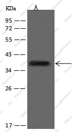 CD20/MS4A1 Monoclonal Antibody - 1