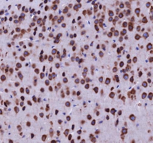 Recombinant DDX3 Monoclonal Antibody - small - 3