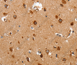 HSP75 Polyclonal Antibody - 3