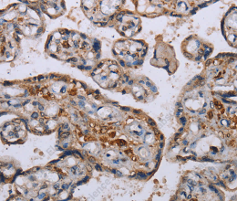 P3H3 Polyclonal Antibody - 3
