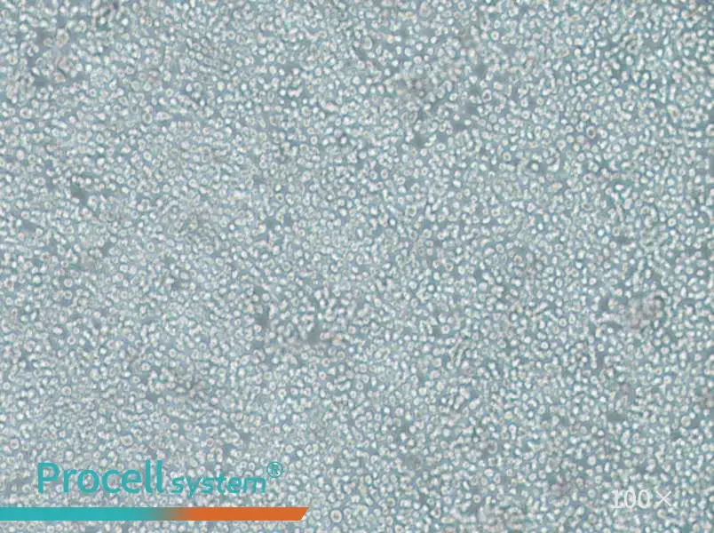 SKNO-1 Cell Complete Medium - 1