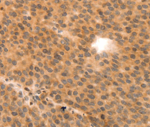 MYL9 Polyclonal Antibody - 2