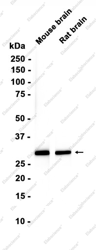 Recombinant Calretinin Monoclonal Antibody - 1