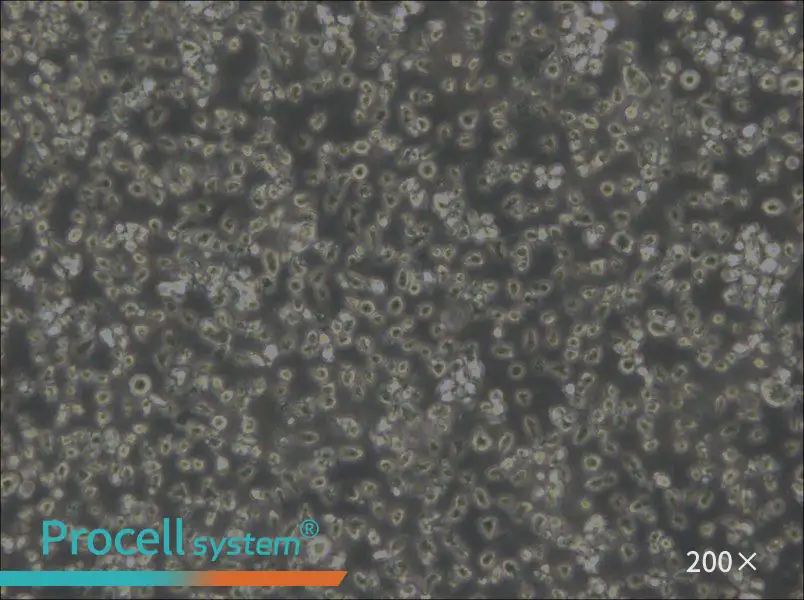 MEC-1 Cell Complete Medium - 4