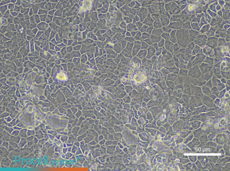 Rat Retinal Pigment Epithelial CellsRat Retinal Pigment Epithelial Cells - 3