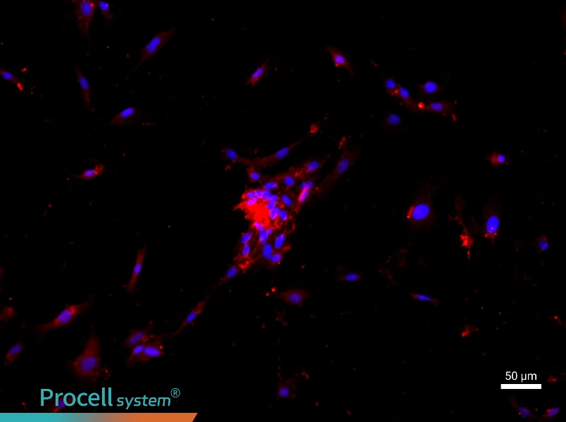 Mouse Cardiac Microvascular Endothelial Cell Complete Medium - 1