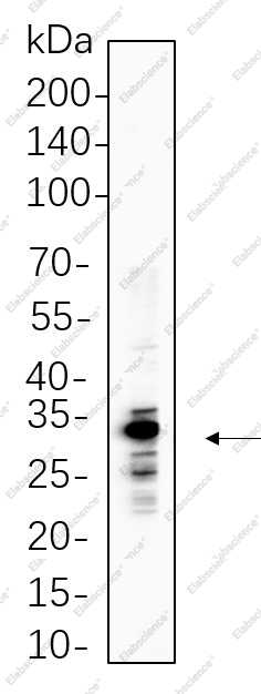 Recombinant ELNE Monoclonal Antibody - 1