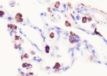 Recombinant SFTPA1+SFTPA2 Monoclonal Antibody-searchlist-3