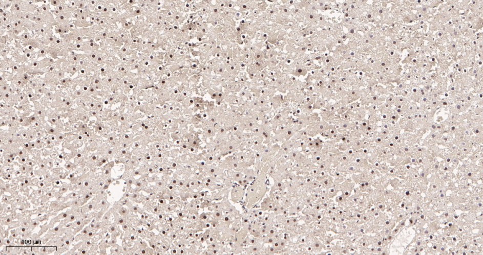 Recombinant Glucocorticoid Receptor Monoclonal Antibody - small - 3