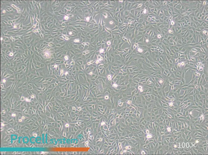 9L/lacZ Cell Complete Medium - 2