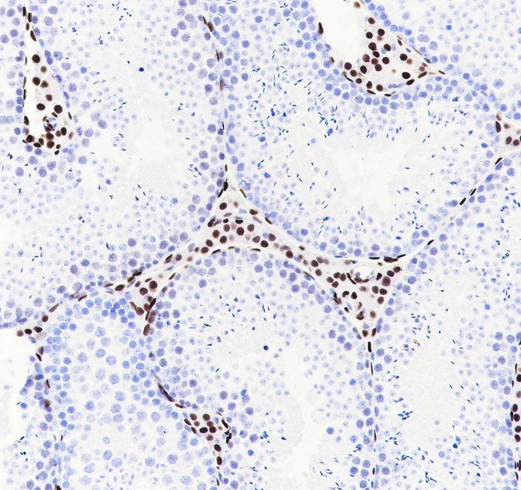 Recombinant COUP-TFII Monoclonal Antibody - small - 4