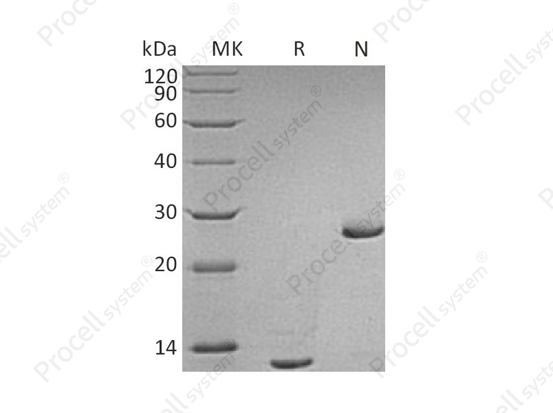 TGF&beta;2/TGFB2, Human, Recombinant
