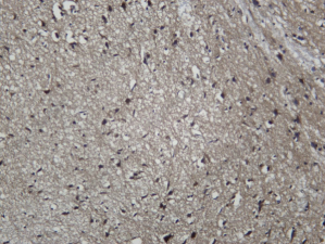 Recombinant Presenilin 1 Monoclonal Antibody - 4