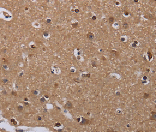 MCTS1 Polyclonal Antibody - 3
