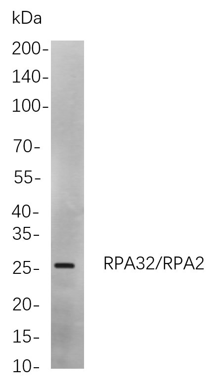 Recombinant RPA32/RPA2 Monoclonal Antibody-searchlist-1