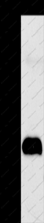 AGPAT2 Polyclonal Antibody - 1