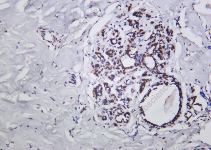 Recombinant Phospho-p53 (Ser15) Monoclonal Antibody - 1