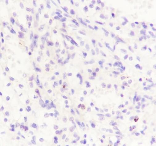 Recombinant GATA3 Monoclonal Antibody - small - 4