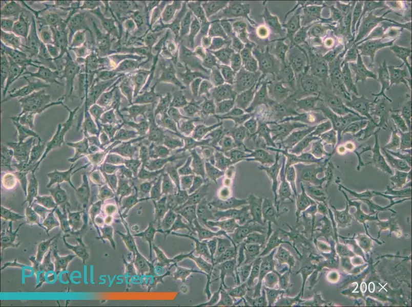 NCI-H3122 Cell Complete Medium - small - 5